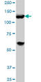 Histone Deacetylase 4 antibody, LS-B6200, Lifespan Biosciences, Western Blot image 