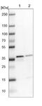 Elongation of very long chain fatty acids protein 7 antibody, NBP1-93926, Novus Biologicals, Western Blot image 