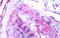 BKRB1 antibody, SP4076P, Origene, Immunohistochemistry paraffin image 