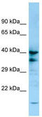 Purinergic Receptor P2Y13 antibody, TA337752, Origene, Western Blot image 