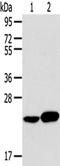 RAB8A, Member RAS Oncogene Family antibody, TA322620, Origene, Western Blot image 