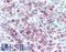 Sialophorin antibody, LS-B16131, Lifespan Biosciences, Immunohistochemistry paraffin image 
