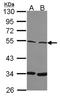SWI/SNF Related, Matrix Associated, Actin Dependent Regulator Of Chromatin, Subfamily E, Member 1 antibody, NBP2-15540, Novus Biologicals, Western Blot image 