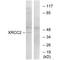 DNA repair protein XRCC2 antibody, A02138, Boster Biological Technology, Western Blot image 