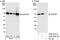Zinc Finger Protein 768 antibody, A302-387A, Bethyl Labs, Western Blot image 