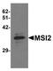Musashi RNA Binding Protein 2 antibody, PA5-21145, Invitrogen Antibodies, Western Blot image 