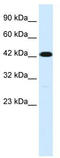 Transmembrane Protein 259 antibody, TA334763, Origene, Western Blot image 