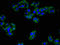 ADP-Ribosyltransferase 3 antibody, orb400652, Biorbyt, Immunocytochemistry image 