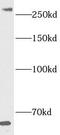 Histone-lysine N-methyltransferase SETD1B antibody, FNab07766, FineTest, Western Blot image 