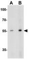 Amyloid Beta Precursor Protein Binding Protein 2 antibody, GTX31561, GeneTex, Western Blot image 