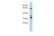 S100P Binding Protein antibody, GTX45092, GeneTex, Western Blot image 