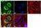 Retinoic Acid Receptor Beta antibody, PA1-811, Invitrogen Antibodies, Immunofluorescence image 