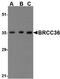 BRCA1/BRCA2-Containing Complex Subunit 3 antibody, GTX31248, GeneTex, Western Blot image 