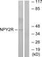 Neuropeptide Y Receptor Y2 antibody, GTX87927, GeneTex, Western Blot image 