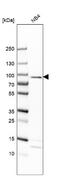 Eosinophil peroxidase antibody, NBP2-13967, Novus Biologicals, Western Blot image 