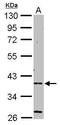 5 -AMP-activated protein kinase subunit gamma-2 antibody, TA307890, Origene, Western Blot image 