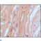 Natriuretic Peptide B antibody, LS-C813344, Lifespan Biosciences, Immunohistochemistry paraffin image 