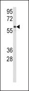 Cytochrome P450 Family 2 Subfamily C Member 9 antibody, 63-259, ProSci, Western Blot image 