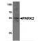Parkin RBR E3 Ubiquitin Protein Ligase antibody, TA349075, Origene, Western Blot image 