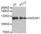 Glutamate Ionotropic Receptor NMDA Type Subunit 1 antibody, LS-B13901, Lifespan Biosciences, Western Blot image 