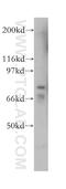 Arachidonate 15-Lipoxygenase Type B antibody, 13073-1-AP, Proteintech Group, Western Blot image 