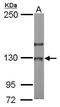 Nucleolar Protein 6 antibody, GTX116786, GeneTex, Western Blot image 