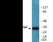 Cyclin Dependent Kinase Inhibitor 1C antibody, EKC2267, Boster Biological Technology, Western Blot image 