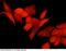 Ribosomal Protein S6 Kinase B1 antibody, 10099-T38, Sino Biological, Immunohistochemistry frozen image 