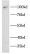 Eukaryotic Elongation Factor 2 Kinase antibody, FNab02652, FineTest, Western Blot image 