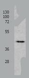 CHRNA7-FAM7A fusion protein antibody, TA321939, Origene, Western Blot image 