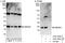 Ubiquitin-conjugating enzyme E2 E2 antibody, A303-485A, Bethyl Labs, Western Blot image 