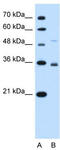 Sodium-coupled neutral amino acid transporter 3 antibody, TA346441, Origene, Western Blot image 