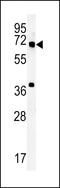 Methyltransferase-like protein 16 antibody, LS-C164148, Lifespan Biosciences, Western Blot image 