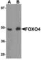 Forkhead Box O4 antibody, LS-B5285, Lifespan Biosciences, Western Blot image 