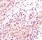 Akt antibody, MA5-14916, Invitrogen Antibodies, Immunohistochemistry frozen image 