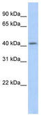 Spermatogenesis And Oogenesis Specific Basic Helix-Loop-Helix 1 antibody, TA341546, Origene, Western Blot image 
