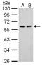 Sestrin-2 antibody, NBP2-20317, Novus Biologicals, Western Blot image 