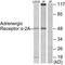 Adrenoceptor Alpha 2A antibody, TA313317, Origene, Western Blot image 