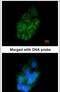 Annexin A2 antibody, PA5-27566, Invitrogen Antibodies, Immunofluorescence image 