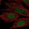 CCD36 antibody, NBP2-57300, Novus Biologicals, Immunocytochemistry image 