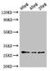 Arabidopsis thaliana L-ascorbate peroxidase 2,cytosolic antibody, orb240393, Biorbyt, Western Blot image 