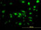 Capping Actin Protein, Gelsolin Like antibody, LS-C196813, Lifespan Biosciences, Immunofluorescence image 