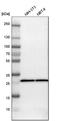 Succinate dehydrogenase [ubiquinone] iron-sulfur subunit, mitochondrial antibody, HPA002868, Atlas Antibodies, Western Blot image 
