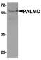 Palmdelphin antibody, PA5-72871, Invitrogen Antibodies, Western Blot image 