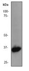 Lactate Dehydrogenase B antibody, ab52488, Abcam, Western Blot image 