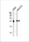 Mesoderm Development LRP Chaperone antibody, TA324417, Origene, Western Blot image 