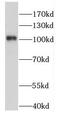 Family With Sequence Similarity 160 Member B1 antibody, FNab02970, FineTest, Western Blot image 