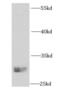 Neurotrophin 3 antibody, FNab05882, FineTest, Western Blot image 