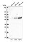Golgi Associated PDZ And Coiled-Coil Motif Containing antibody, NBP1-88223, Novus Biologicals, Western Blot image 