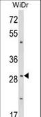 ZFP36 Ring Finger Protein antibody, LS-C160774, Lifespan Biosciences, Western Blot image 